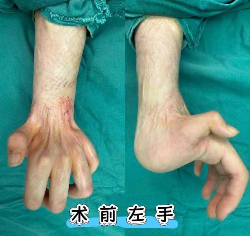 北京安贞医院南充医院